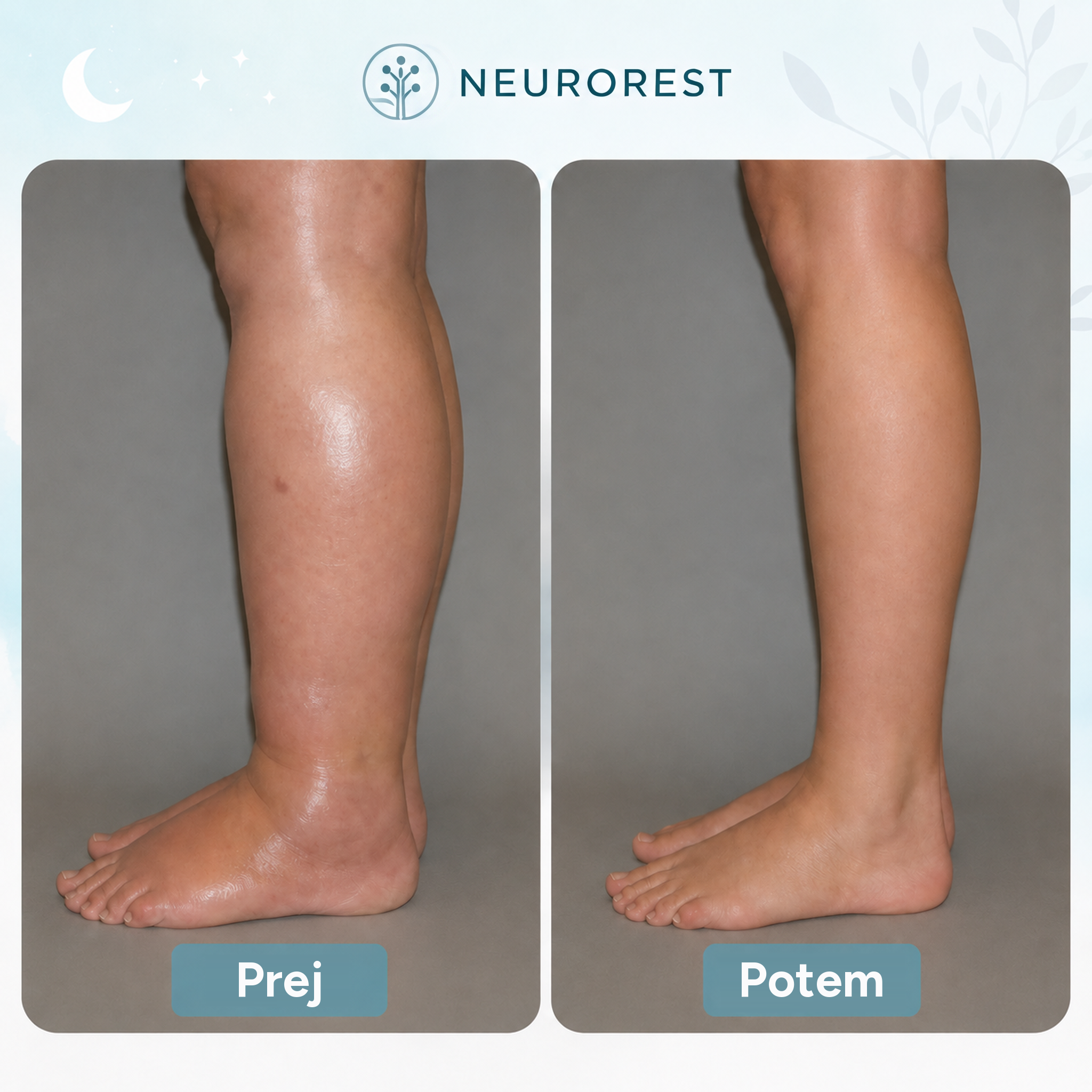 NeuroRest EMS aktivator za noge